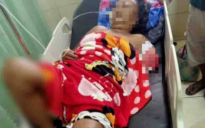 Seorang nenek dirawat di RSUD dr Murjani Sampit karena jadi korban serangan buaya hingga tangan putus dan kaki patah.