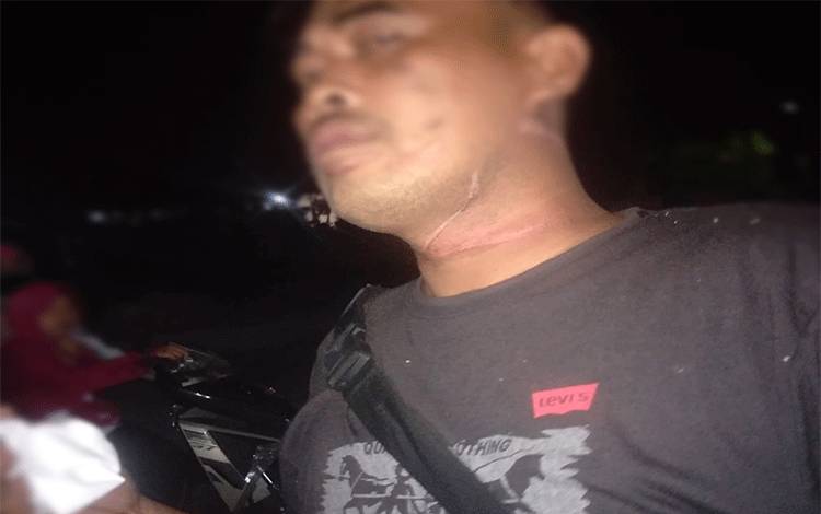 Lilitan kabel membentang di jalan terlihat membekas di leher pengendara.