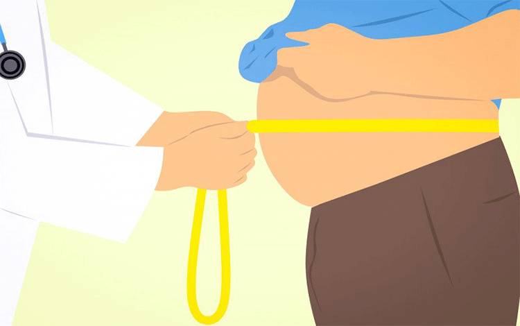 Ilustrasi obesitas (Pixabay)