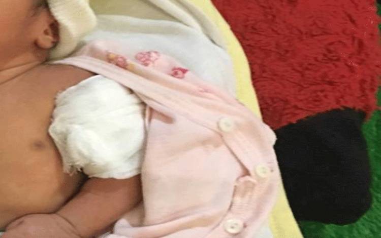 Diduga Tangan Bayi Patah Usai Lahir, Legislator Ini Minta Panggil Pihak Puskesmas