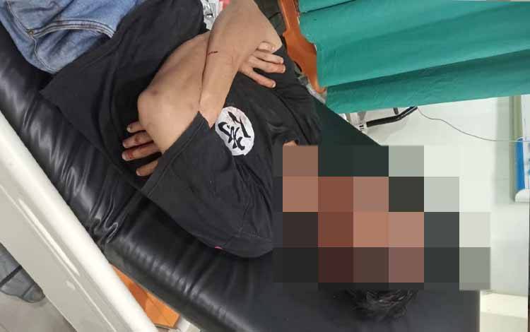 2 Pemuda Dikeroyok Orang karena Knalpot Bising di Baamang