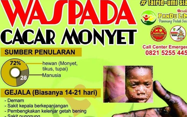 Lurah Panarung Imbau Waspada Cacar Monyet