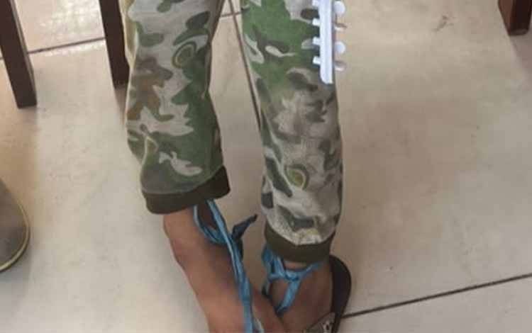 Seorang Anak Ditemukan Dalam Kondisi Kaki Terikat, Kelurahan Panarung Siap Bantu Sekolahkan