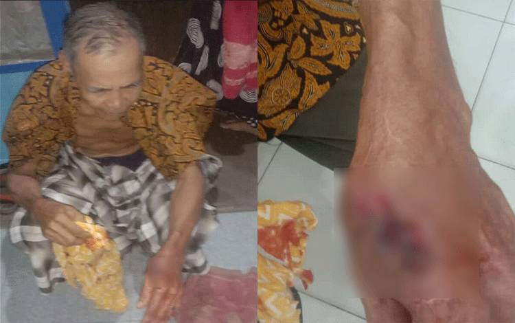 Warga Jalan Padat Karya RT 23 MHS tangan kirinya diserang buaya muara saat hendak wudhu. (FOTO: IST)