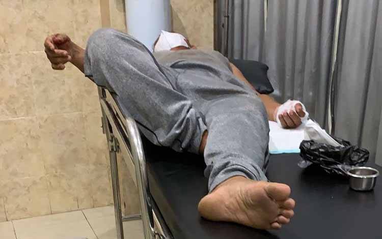 Kera Peliharaan Mengamuk Serang Warga, Seorang Pria Alami Luka-luka