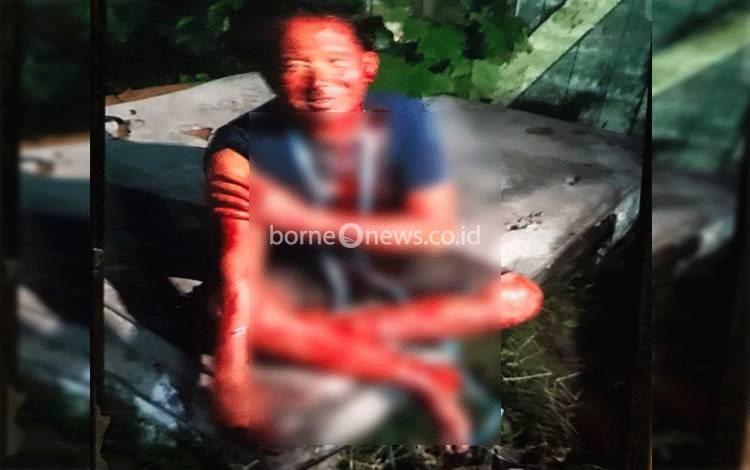Diduga Menjadi Korban Perkelahian, Pria di Sampit Berlumuran Darah