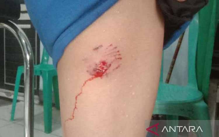 Seorang Anak di NTT Meninggal Usai Digigit Anjing Rabies