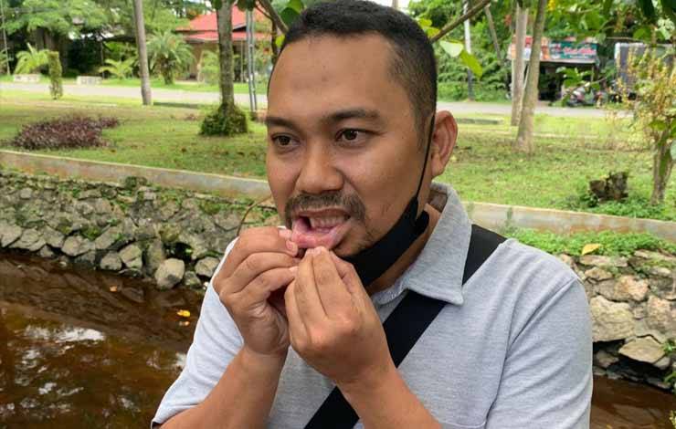 Jemput Pelanggan, Lulu Dapat Bogem Mentah dari Oknum Driver Taksi Bandara