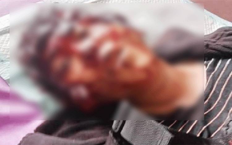 Masih Buron, Suami Aniaya Istri Hingga Telinga Nyaris Putus di Lamandau