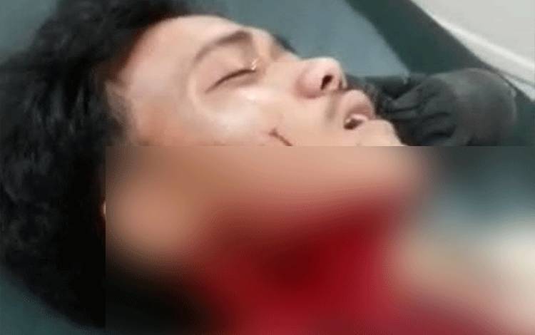 Niat Mencari HP Tertinggal di Warung Makan malah jadi Korban Penikaman