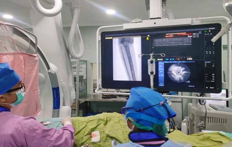RSUD dr Doris Sylvanus Sukses Lakukan Tindakan Vacular Pertama di Kalteng