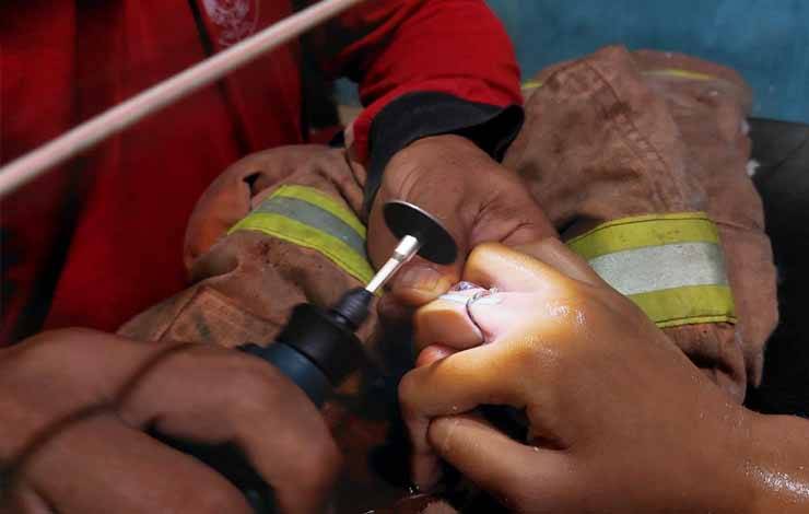 Cincin Sulit Dilepas Akibat Jari Bengkak, Dewite Minta Tolong DPKP
