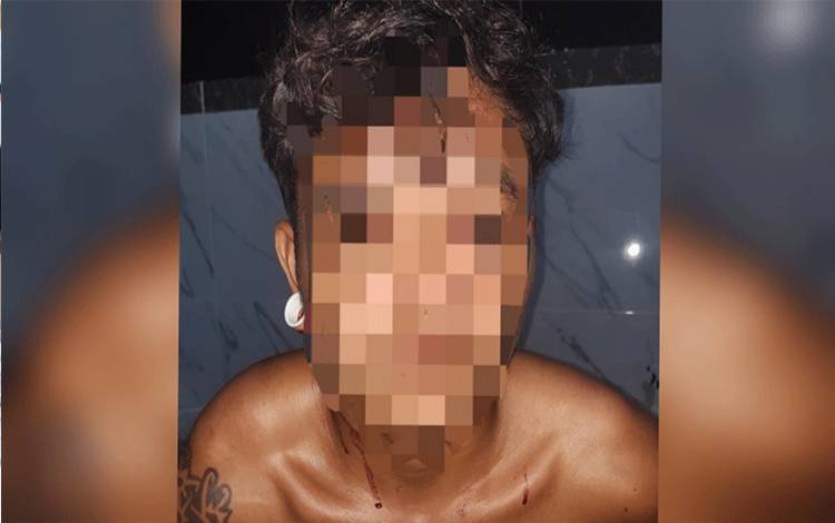 Ini Sebab Pelaku Bacok Korban Hingga Luka Berat di Kapuas