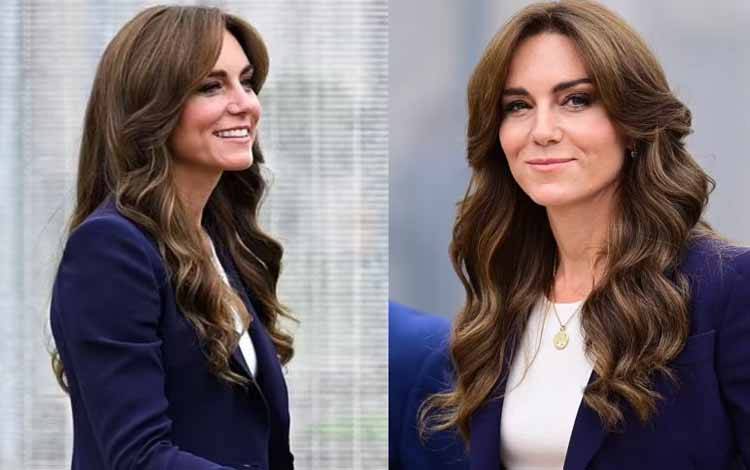 Kate Middleton Didiagnosis Mengidap Kanker