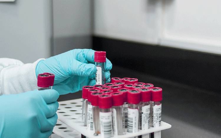 Fasilitas Pengobatan Tuberkulosis Resisten Obat Kalteng Masih Minim