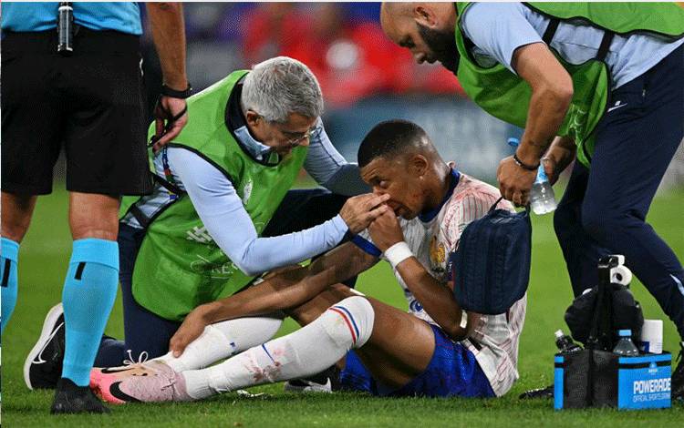 Mbappe Cedera Patah Tulang Hidung