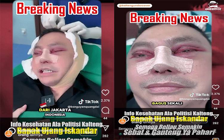 Sebelum Ditangkap Beredar di Medsos Ujang Iskandar Operasi Wajah di Vietnam