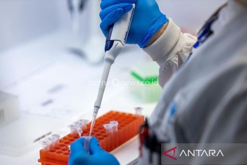Virus mpox sedang menyebar ke banyak negara di benua Afrika. (ANTARA/Anadolu/www.aa.com.tr)