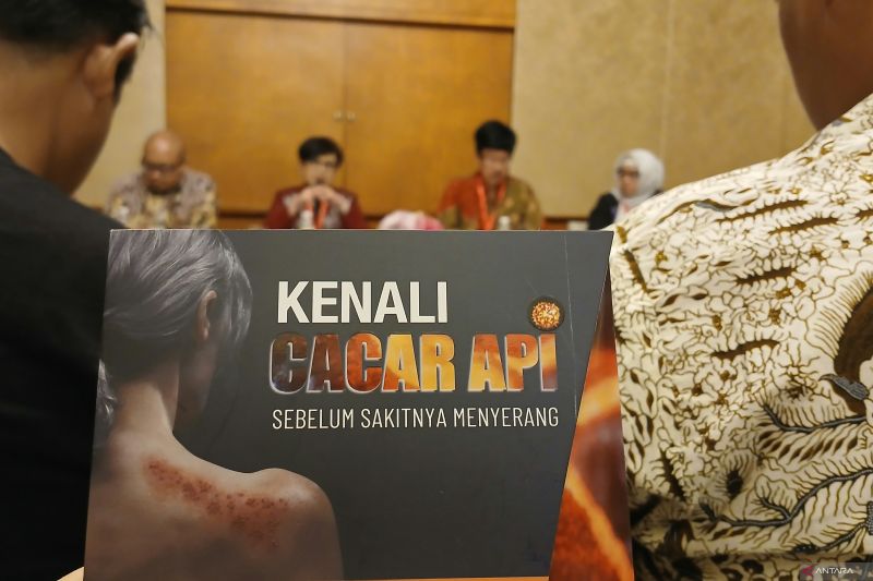 Pentingnya Vaksinasi Cacar Api Untuk Dewasa dan Lansia