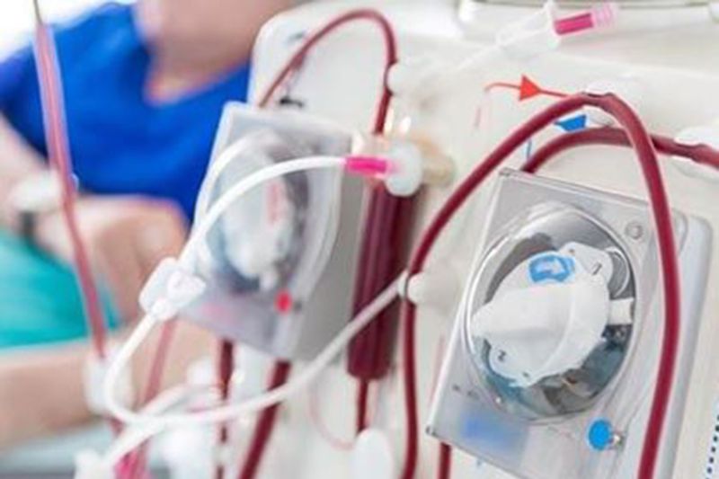 Iklim Lembab Indonesia, Pentingnya Penggantian Catheter Double Lumen