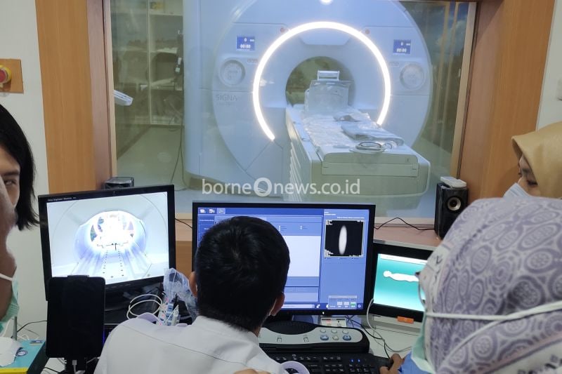 Peran CT Scan dan MRI dalam Diagnosis Aneurisma Otak yang Akurat