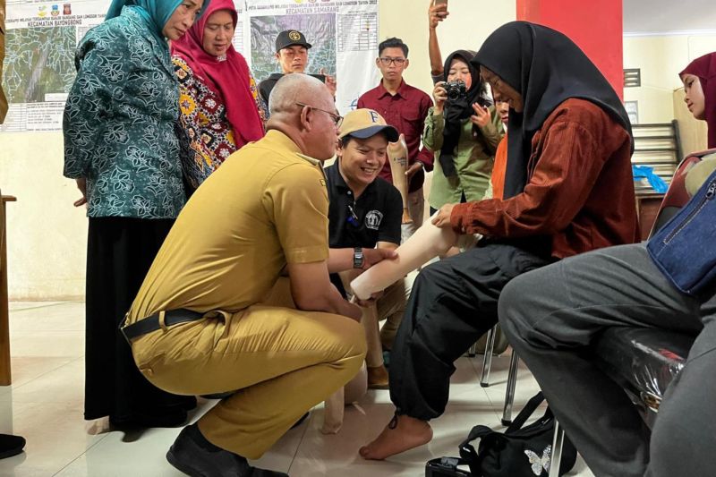 Pemerintah Garut Salurkan 59 Kaki dan Tangan Palsu gratis untuk Penyandang Tunadaksa