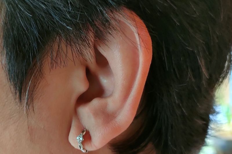 Tinnitus, Kenali Gejala dan Penyebabnya untuk Penanganan Tepat