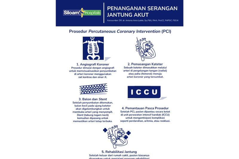 Mengenal Gejala dan Prosedur PCI pada Serangan Jantung Akut