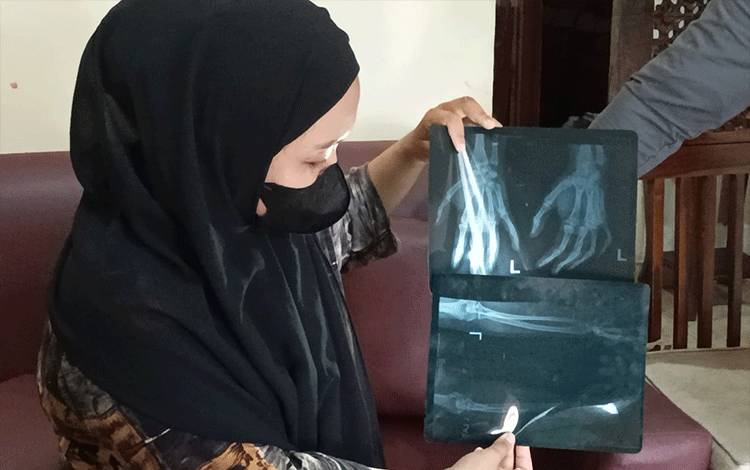 Suami Biadab Aniaya Istri hingga Keguguran dan Patah Jari, Korban Lapor Polresta Palangka Raya