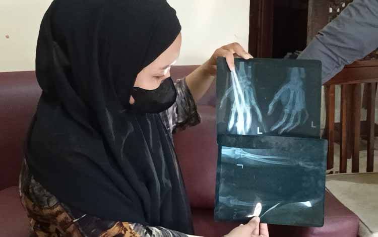 Hobi Mancing Jadi Pemicu Kekerasan, Suami Aniaya Istri hingga Keguguran dan Patah Jari