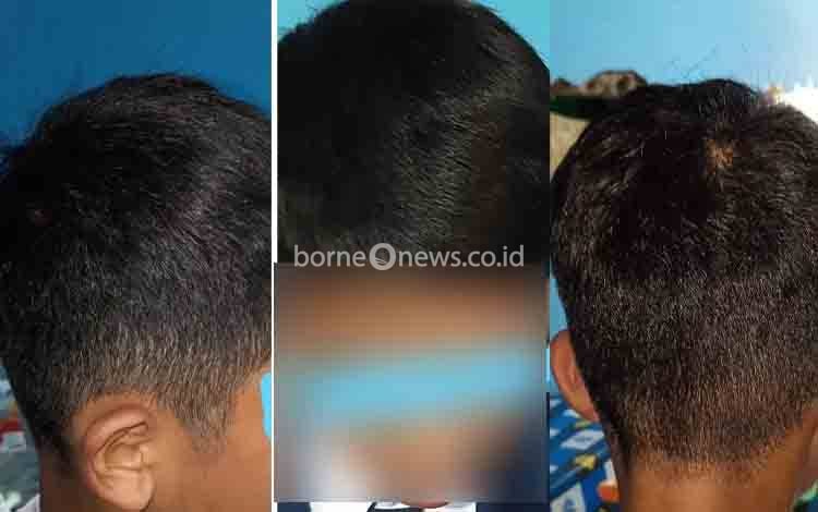 Anak Dilarang Ikut Ujian Karena Masalah Rambut, Orang Tua Mengadu di Media Sosial Sebut Disdik Kotim