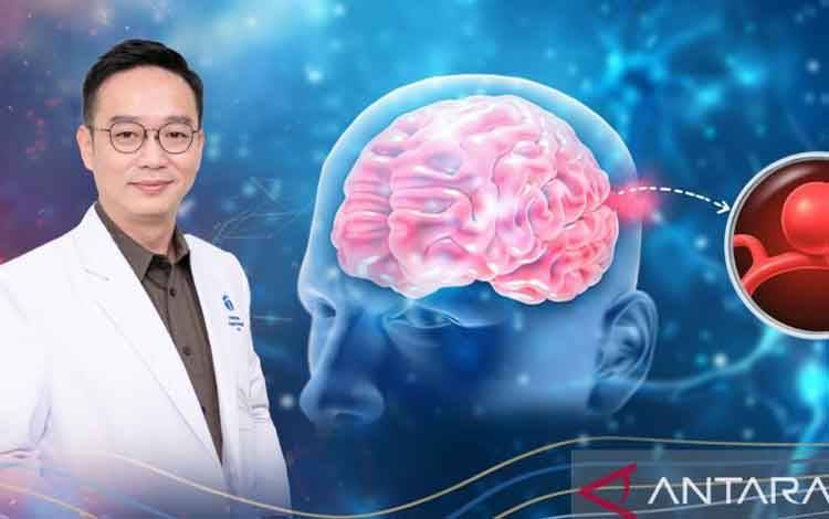 Dokter: Perlu Kenali Bahaya dan Risiko Aneurisma pada Otak