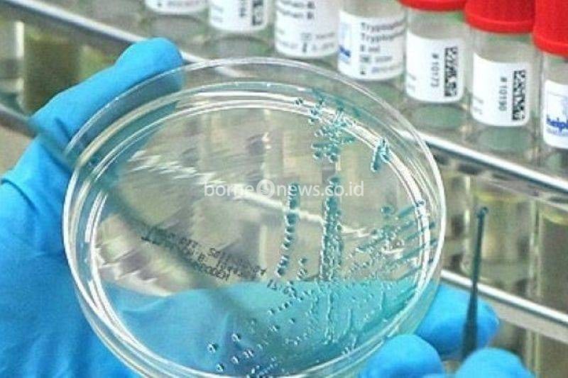 Sebuah kasus langka infeksi flu burung subtipe A(H5N1) pada manusia telah dilaporkan di Inggris, menurut Badan Keamanan Kesehatan Inggris (UKHSA) pada Senin (27/1/2025). ANTARA/foto-Anadolu/py.