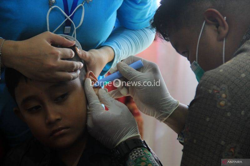 Arsip foto - Seorang anak menjalani pemeriksaan kesehatan telinga di Pontianak, Kalimantan Barat, Minggu (4/8/2024, dalam pelayanan kesehatan yang digelar oleh Perhimpunan Dokter Spesialis Telinga Hidung Tenggorok Bedah Kepala dan Leher (PERHATI-KL) bersama Kesdam XII/Tanjungpura dan Dinas Kesehatan. (ANTARA FOTO/Jessica Wuysang/rwa)