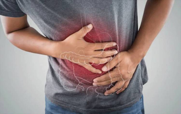 Dokter Sebut IBD Bisa Disembuhkan dengan Perawatan