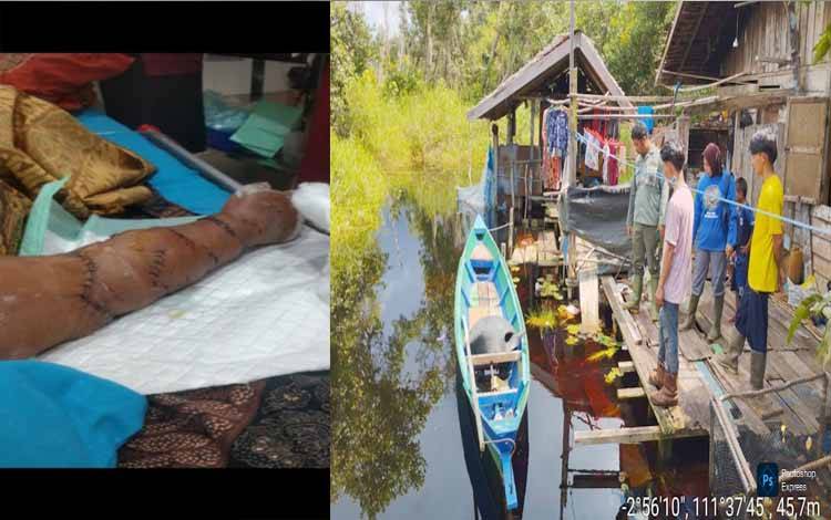 Buaya Muara Serang Warga Sungai Benipah, Korban Alami Luka Serius