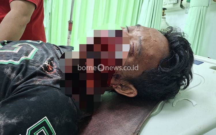 Penganiayaan Brutal Terjadi di Kapuas Barat, Wajah Pria ini Luka Berlumuran Darah