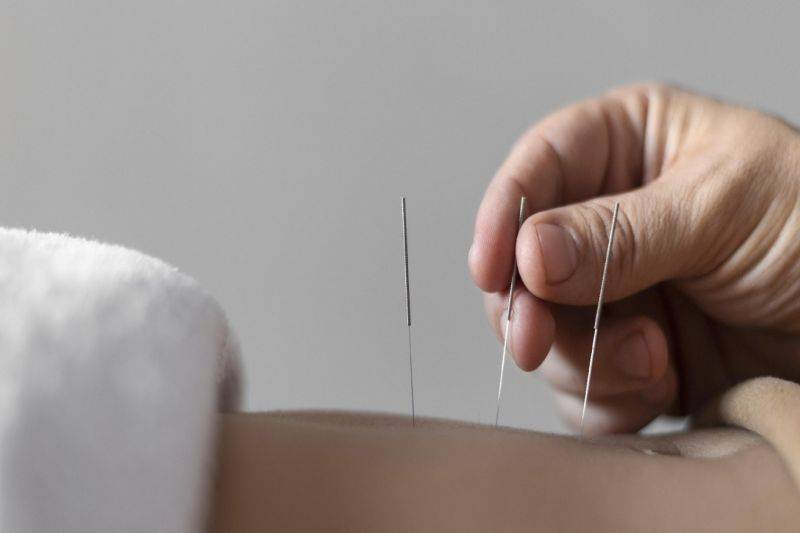 Dokter Sebut Akupunktur Wajah Bikin Kulit Lebih Cerah Segar dan Sehat
