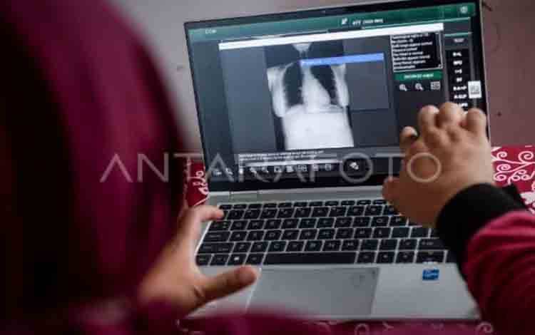 RI Tambah Anggaran Khusus Guna Percepatan Deteksi TBC pada 2026