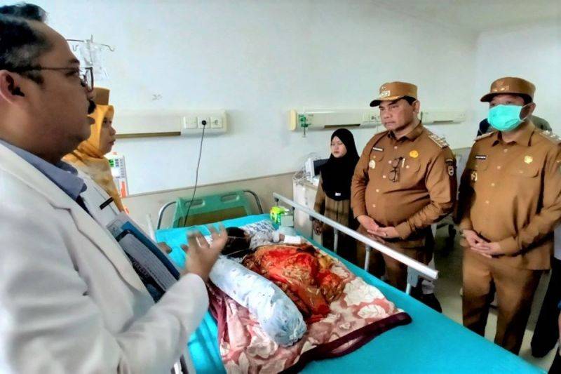 Pemkab Barito Utara Pastikan Perawatan Optimal untuk Bayi Penderita Hidrosefalus