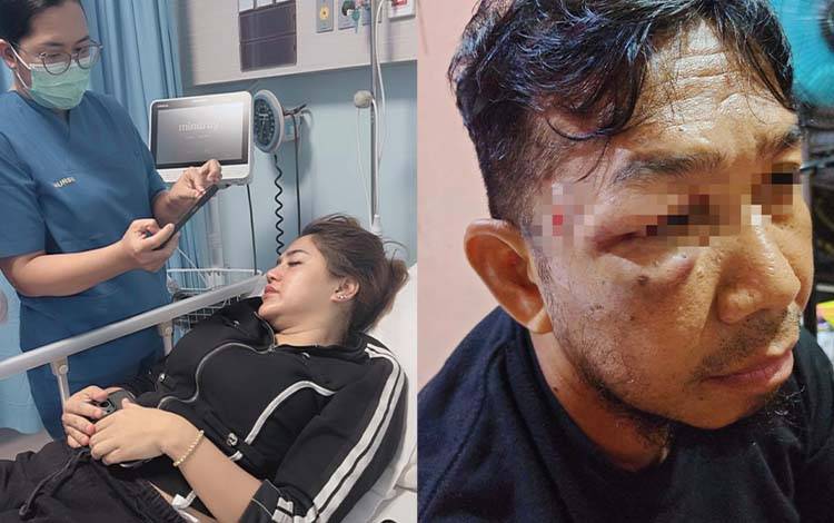 Korban KDRT di Palangka Raya Minta Perlindungan Polda Kalteng, Terlapor Kembali Menyerang Pakai Parang