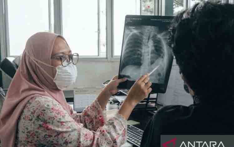 Paparan Asap Karhutla Jangka Panjang Berisiko Turunkan Fungsi Paru