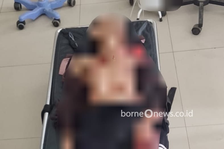 Penganiayaan di Ampah, Lansia 79 Tahun Alami Luka Serius di Dada hingga Bahu