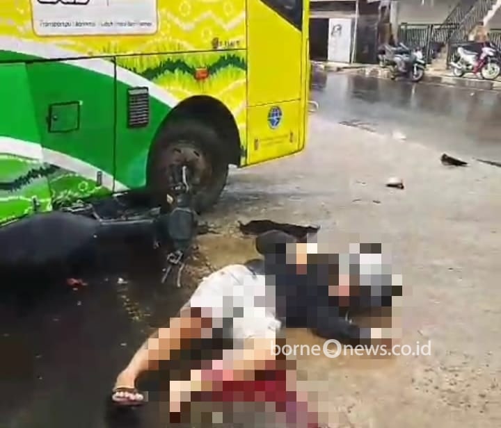 Kaki Pemotor Nyaris Putus Usai Kecelakaan dengan Bus di Antasan Martapura